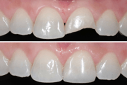 DENTISTERIA/ESTÉTICA DENTÁRIA - Especialidades - Clinica Estomatológica Estoril Sol
