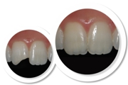 DENTISTERIA/ESTÉTICA DENTÁRIA - Especialidades - Clinica Estomatológica Estoril Sol