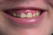 PERIODONTOLOGIA - Especialidades - Clinica Estomatológica Estoril Sol