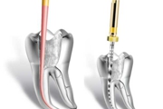 ENDODONTIA - Especialidades - Clinica Estomatológica Estoril Sol
