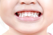 ODONTOPEDIATRIA - Especialidades - Clinica Estomatológica Estoril Sol