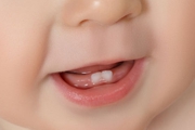 ODONTOPEDIATRIA - Especialidades - Clinica Estomatológica Estoril Sol